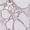 Coatomer Protein Complex Subunit Beta 1 antibody, HPA064403, Atlas Antibodies, Immunohistochemistry frozen image 