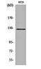 Protein Tyrosine Kinase 2 antibody, orb160986, Biorbyt, Western Blot image 