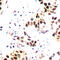 Aurora Kinase B antibody, LS-C358921, Lifespan Biosciences, Immunohistochemistry paraffin image 