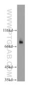 HPS1 antibody, 15077-1-AP, Proteintech Group, Western Blot image 