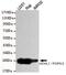Ubiquitin C-Terminal Hydrolase L1 antibody, GTX49143, GeneTex, Western Blot image 