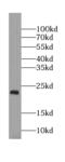 GTPase KRas antibody, FNab04643, FineTest, Western Blot image 