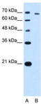 Threonyl-TRNA Synthetase antibody, TA339373, Origene, Western Blot image 