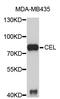 Carboxyl Ester Lipase antibody, STJ23099, St John