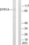 Dual Specificity Tyrosine Phosphorylation Regulated Kinase 1A antibody, LS-C119030, Lifespan Biosciences, Western Blot image 