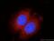 HRas Proto-Oncogene, GTPase antibody, 18295-1-AP, Proteintech Group, Immunofluorescence image 