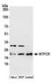 Nucleoside-Triphosphatase, Cancer-Related antibody, A305-697A-M, Bethyl Labs, Western Blot image 
