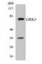 G Protein-Coupled Receptor Kinase 3 antibody, EKC1714, Boster Biological Technology, Western Blot image 