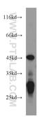 Nudix Hydrolase 19 antibody, 55126-1-AP, Proteintech Group, Western Blot image 