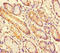 Signal Transducer And Activator Of Transcription 1 antibody, orb44237, Biorbyt, Immunohistochemistry paraffin image 