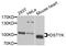 Dual Serine/Threonine And Tyrosine Protein Kinase antibody, STJ111912, St John