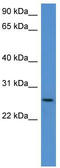 Chondrolectin antibody, TA335399, Origene, Western Blot image 