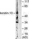 K10 antibody, TA314141, Origene, Western Blot image 
