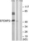 EGF Containing Fibulin Extracellular Matrix Protein 2 antibody, TA315408, Origene, Western Blot image 