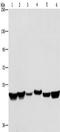 Heterogeneous nuclear ribonucleoprotein H antibody, TA351254, Origene, Western Blot image 