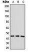 1-Acylglycerol-3-Phosphate O-Acyltransferase 4 antibody, orb224109, Biorbyt, Western Blot image 
