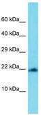 Mitochondrial Ribosomal Protein L22 antibody, TA343251, Origene, Western Blot image 