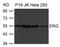 ETS Transcription Factor ERG antibody, PA5-49681, Invitrogen Antibodies, Western Blot image 