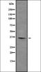 ZFP36 Ring Finger Protein Like 1 antibody, orb378429, Biorbyt, Western Blot image 
