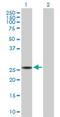 Sepiapterin Reductase antibody, H00006697-D01P, Novus Biologicals, Western Blot image 