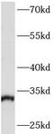 Actin Related Protein 2/3 Complex Subunit 2 antibody, FNab00601, FineTest, Western Blot image 