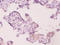 Ubiquitin Conjugating Enzyme E2 K antibody, A53456-100, Epigentek, Immunohistochemistry paraffin image 