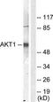 Protein kinase B antibody, TA313247, Origene, Western Blot image 