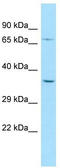 Palmdelphin antibody, TA331278, Origene, Western Blot image 
