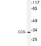 Copper Chaperone For Superoxide Dismutase antibody, LS-C177820, Lifespan Biosciences, Western Blot image 