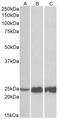 Troponin I2, Fast Skeletal Type antibody, AP32708PU-N, Origene, Western Blot image 