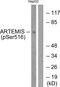 Protein artemis antibody, PA5-38260, Invitrogen Antibodies, Western Blot image 