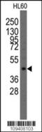LIM Homeobox Transcription Factor 1 Alpha antibody, 57-606, ProSci, Western Blot image 