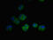 DNA damage-regulated autophagy modulator protein 2 antibody, LS-C675658, Lifespan Biosciences, Immunofluorescence image 