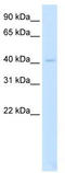 LIM Domain Binding 2 antibody, TA332140, Origene, Western Blot image 