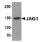 hJ1 antibody, TA349128, Origene, Western Blot image 