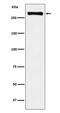 Ubiquitin Specific Peptidase 9 X-Linked antibody, M02594-1, Boster Biological Technology, Western Blot image 