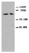 Mitofusin 2 antibody, AP23274PU-N, Origene, Western Blot image 