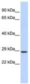 Homeobox protein SIX2 antibody, TA345211, Origene, Western Blot image 