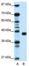 Peroxisome proliferator-activated receptor gamma antibody, TA345179, Origene, Western Blot image 