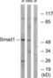 SMAD Family Member 1 antibody, LS-B9239, Lifespan Biosciences, Western Blot image 