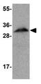 Apolipoprotein A1 antibody, GTX85115, GeneTex, Western Blot image 