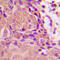 CDKN2A antibody, GTX32378, GeneTex, Immunohistochemistry paraffin image 