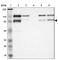 Vezatin, Adherens Junctions Transmembrane Protein antibody, HPA004811, Atlas Antibodies, Western Blot image 