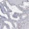 Spermatogenesis Associated 18 antibody, HPA036854, Atlas Antibodies, Immunohistochemistry frozen image 