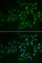 Myosin Light Chain Kinase 3 antibody, LS-C334860, Lifespan Biosciences, Immunofluorescence image 