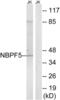 Neuroblastoma breakpoint family member 5 antibody, abx014654, Abbexa, Western Blot image 