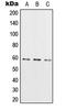 RIO Kinase 3 antibody, LS-C353091, Lifespan Biosciences, Western Blot image 