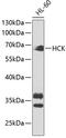 HCK Proto-Oncogene, Src Family Tyrosine Kinase antibody, GTX32645, GeneTex, Western Blot image 