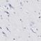 Radial Spoke Head Component 1 antibody, NBP1-89839, Novus Biologicals, Immunohistochemistry paraffin image 