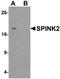 Serine Peptidase Inhibitor, Kazal Type 2 antibody, A11403, Boster Biological Technology, Western Blot image 
